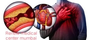 Heart blockage ESMR therapy